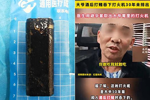 OC: в&nbsp;Китае мужчина проглотил на&nbsp;спор зажигалку и&nbsp;проходил с&nbsp;ней 30&nbsp;лет